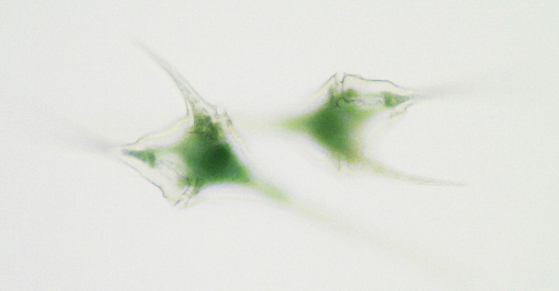 Ceratium, a dinoflagellate @400xTM.