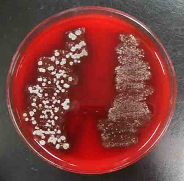 Alpha Hemolysis on Blood Agar, Indicating Normal Flora