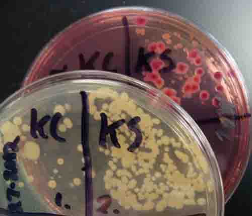 Sample taken from kitchen sink and plated on Tryptic Soy Agar (front, all-purpose medium) and MacConkey's (back). Note bright pink coliform bacterial colonies.
