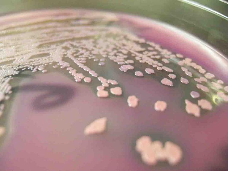 E. coli Lac + Bacterial Growth on MacConkey's Agar