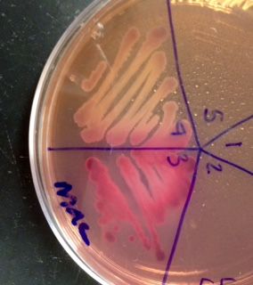 MacConkey's Agar (MAC):  Growing Salmonella (colorless) in section 4) and E. coli (bright pink in section 5).