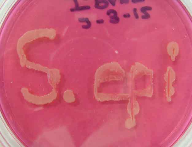 staphylococcus epidermidis streak plate