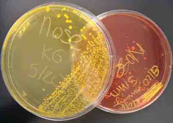 Two plates of Mannitol Salt agar. On left, plate is growtin Staphylococcus aureus, a pathogenic mannitol fermenter. On right, plate is growting non-mannitol fermenter S. epidermidis