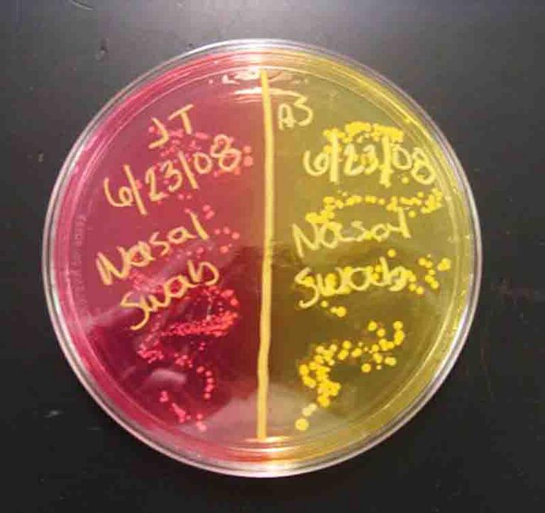 Nasal Swab Sample on Mannitol Salt Agar (MSA). Non-mannitol Fermenter on Left. Mannitol Fermenter Right