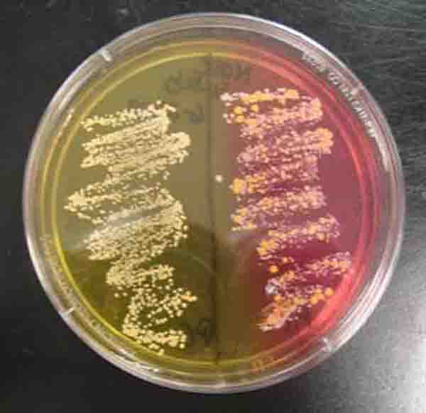 Mannitol Salt Agar grows halophilic (salt-loving) bacteria. Pathogenic Staph is growing on the left (yellow side) and normal flora Staph are growing on the right (pink). ​