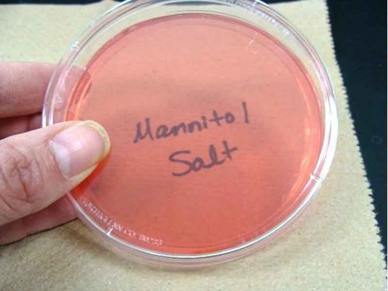 Photo of Sterile Mannitol Salt Agar