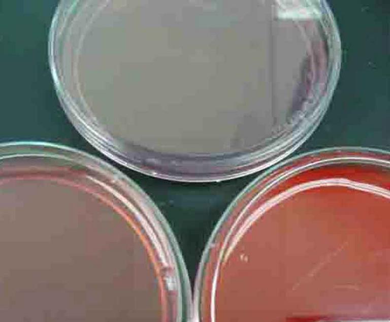 Sterile MacConkey's, Blood agar, Mannitol Salt Bacterial Growth Agar (clockwise from top)