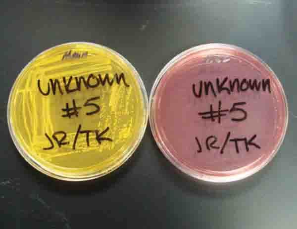 Bacterial unknown plated both on Mannitol Salt and MacConkey's