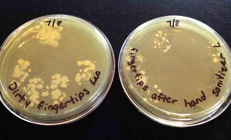Touch plates of bacteria on fingertips: Left plate dirty hands, right plate after alcohol-based hand sanitizer.