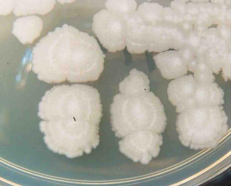 Bacterial Colony Morphology Chart