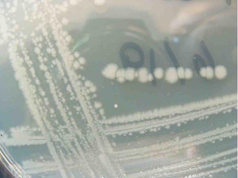 Bacterial Colonies Streak Plate Free Images Photographs Page 2