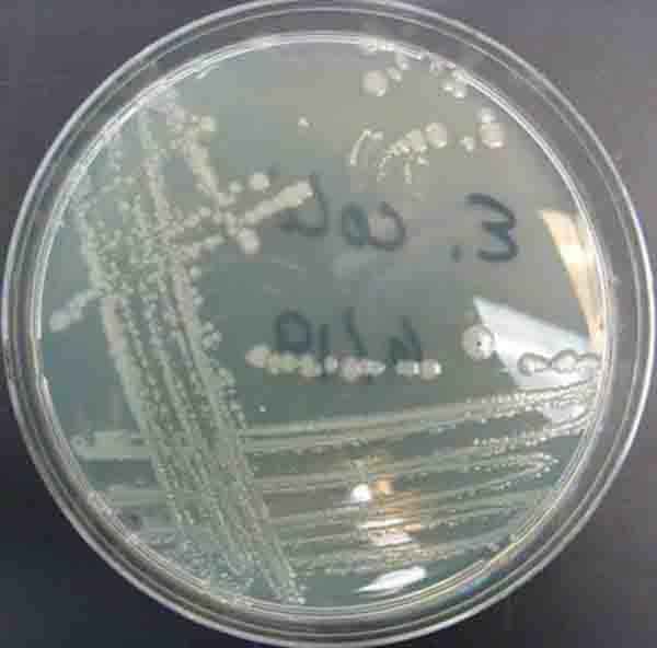 Bacterial Colonies Streak Plate Free Images Photographs Page 2