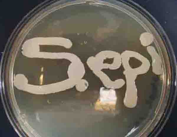 Plate of Staphylococcus epidermiis colonies written as S. epi, and growing on TSY agar