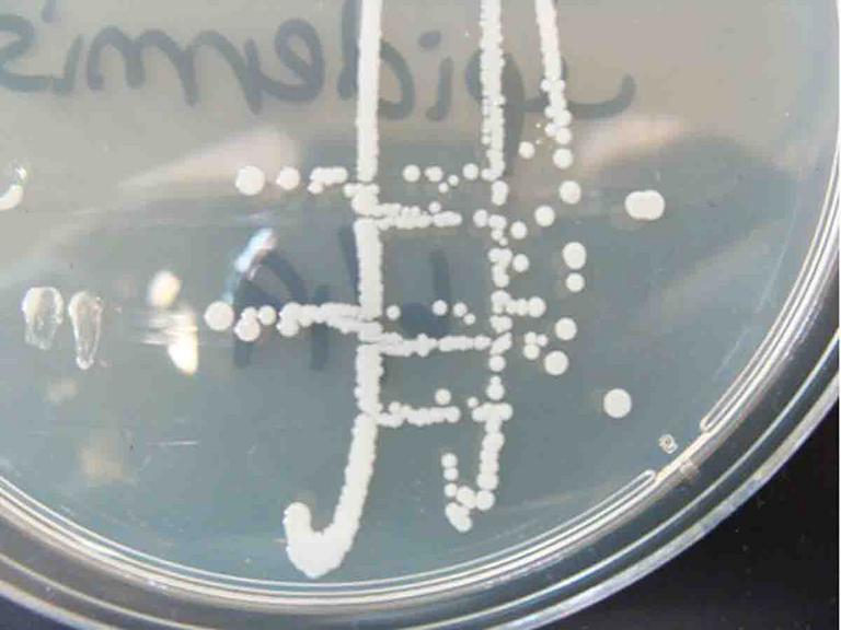 Photo of Bacterial Colonies of Staphylococcus on TSY Agar