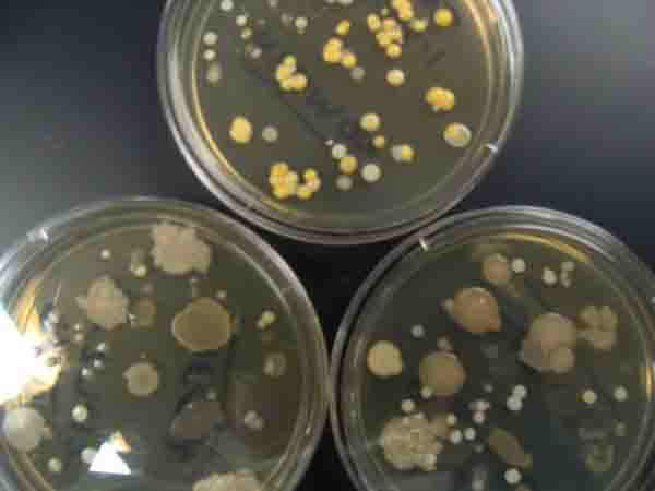 Bacterial Colonies & Streak Plate: Free Images & Photographs from