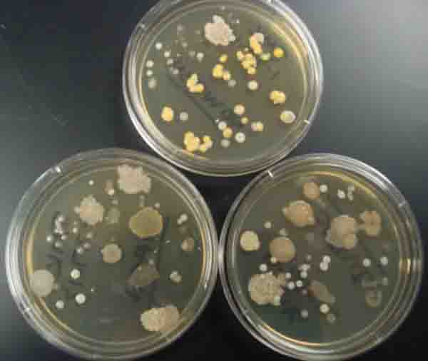 petri dish bacteria growth