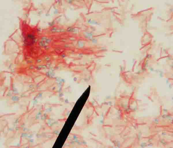 Endospore stained Bacillus subtilis. The vegetative cells (living cells) stain pink and the endospores blue-green.