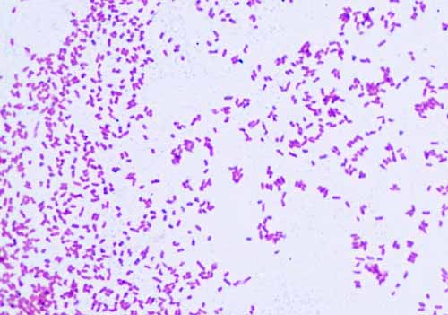Gram Negative Bacteria Images Photos Of Escherichia Coli Salmonella Enterobacter
