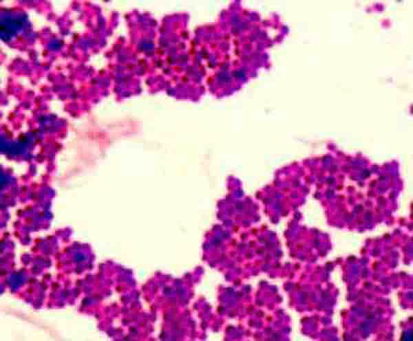 Gram stain of Gram+ Staphylococcus 1000xTM+