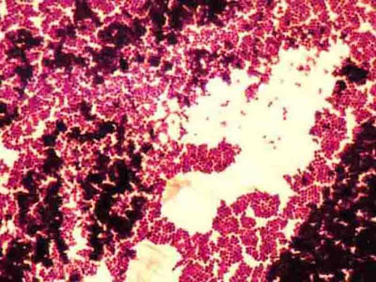staphylococcus epidermidis gram stain