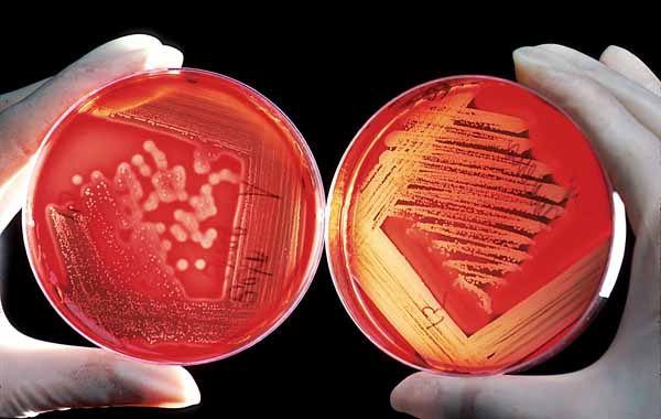 Two different styles of streak plate techniques on Blood Agar