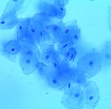 Human Cheek epithelial cells stained with methylene blue and viewed at 400xTM.
