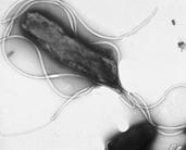 Helicobacter pylori bacteria showing flagella