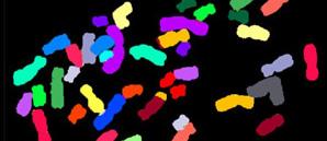 Color Coded Chromosomes Using Fluorescent Dyes