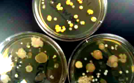 Touch plates of TSY bacteria inoculated with bacteria from unwashed fingertips.