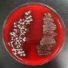 Photos of Blood agar showing beta, alpha & gamma hemolysis patterns.