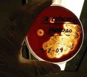 Beta-hemolytic Streptococcus pyogenes plated on Blood Agar. 