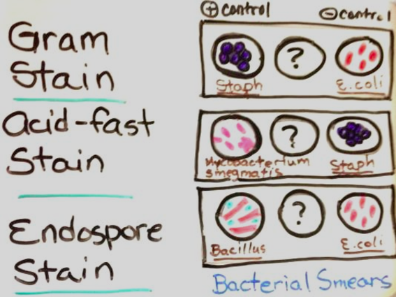 Diagram of bacterial controls used for Gram, Acid-fast and Endospore differential staining.