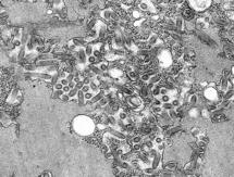 Ravies virus photo taken with transmission electron microscope. Public helath Image Library #1876
