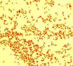 Gram Stain of Gram-negative Bacteria E. coli @1000xTM
