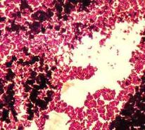 Gram-positive  Staphylococcus viewed  @ 1000xTM