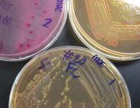 MacConkey's Agar Growing E. coli, Enterobacter & Salmonella (clockwise from top left plate).