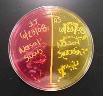 Mannitol Salt Agar Growing Halophilic Mannitol -neg on Left Side and Halophilic Mannitol-pos on Right Bacteria