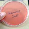 Photos of halophilic bacteria growing on Mannitol Salt Agar.