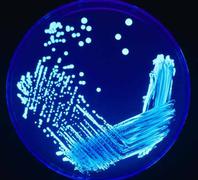 Streak Plate of Legionella Public Health Image Library #7925