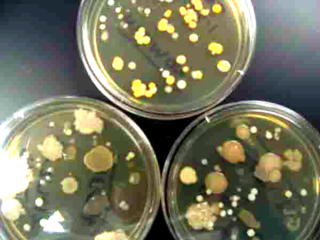 Touch Plates of TSY Bacterial Growth Agar