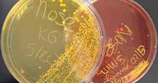 Mannitol Salt Agar: Plate on lect is growing pathogen Staph aureus. Plate on right is growing normal flora, Staph epidermidis. 