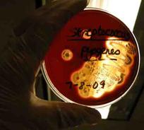 Blood agar (BAP) inoculated with beta-hemolytic Streptococcus pyogenes, cause of strep throat and many other infections. Note the removal of red blood cells from the area of the medium where bacterial colonies of this pathogen is growing. 