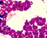 Gram stained Staphylococcus @1000xTM