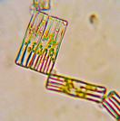 Tabellaria, a Genus of Diatom
