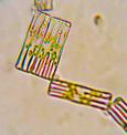 Tabellaria diatom algae pond life/