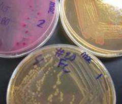 MacConkey's Agar growing E. coli, Enterobacter & Salmonella  (clockwise from top left plate).