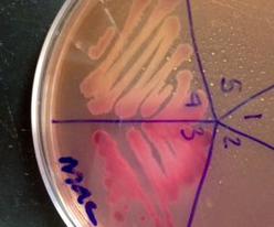 MacConkey's Agar control plate growing E. coli (hot pink #5),  & Salmonella (colorless #4). Staph epi and Staph aureus were also plated, but did not grow because Gram+.