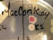 MacConkey's Agar growing Gram-negative bacteria; pink lactose fermenting bacterial colony above colorless non-lactose fermenting bacterial colony.
