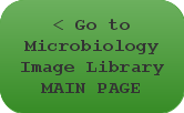 Go to Microbiology Image Library MAIN PAGE