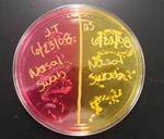 Mannitol Salt Agar with Plated Nasal Samples